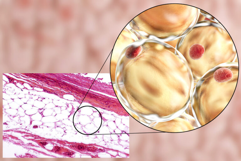 tessuto adiposo (lipocell)